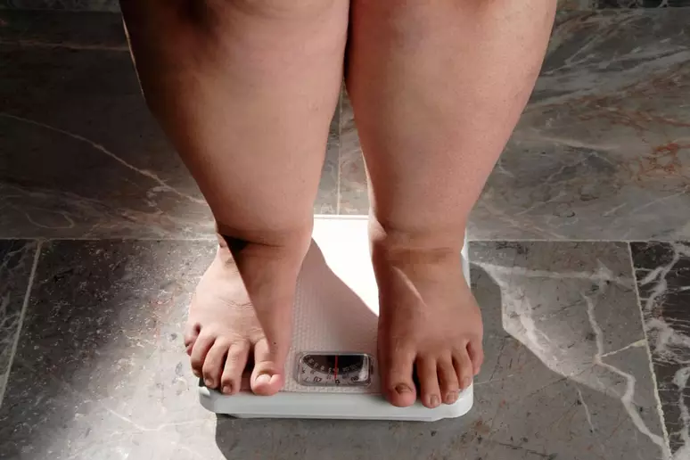 Obesidade no Brasil Um Desafio Nacional